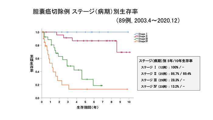 胆嚢がん切除例 ステージ（病期）別生存率