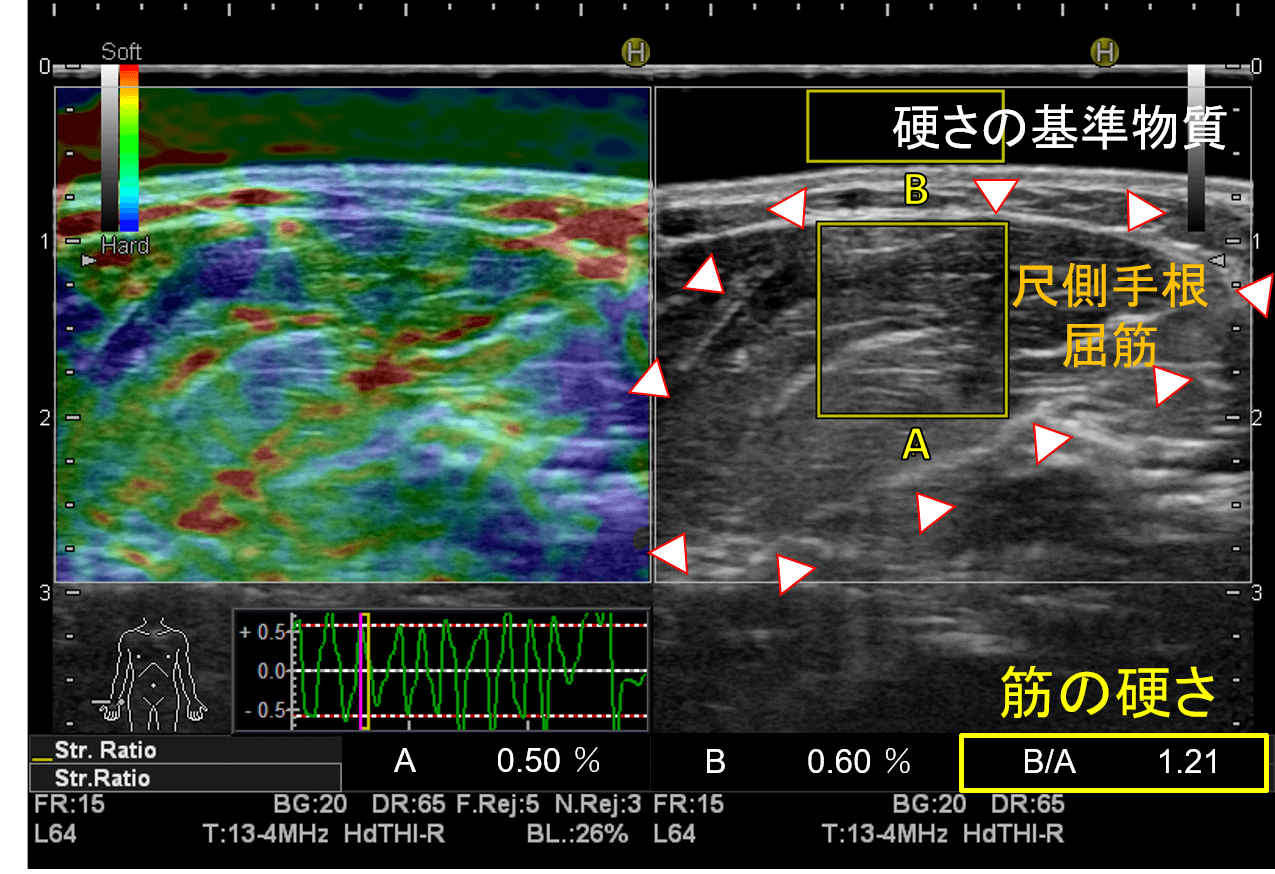理学療法学講座 齊藤 明 講師が代表著者となる学術論文が国際誌『The American Journal of Sports Medicine』に掲載されました