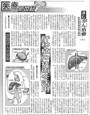 新聞記事　肝移植の技術を活用