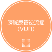 膀胱尿管逆流症（VUR）