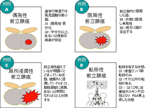 Jewett Staging System