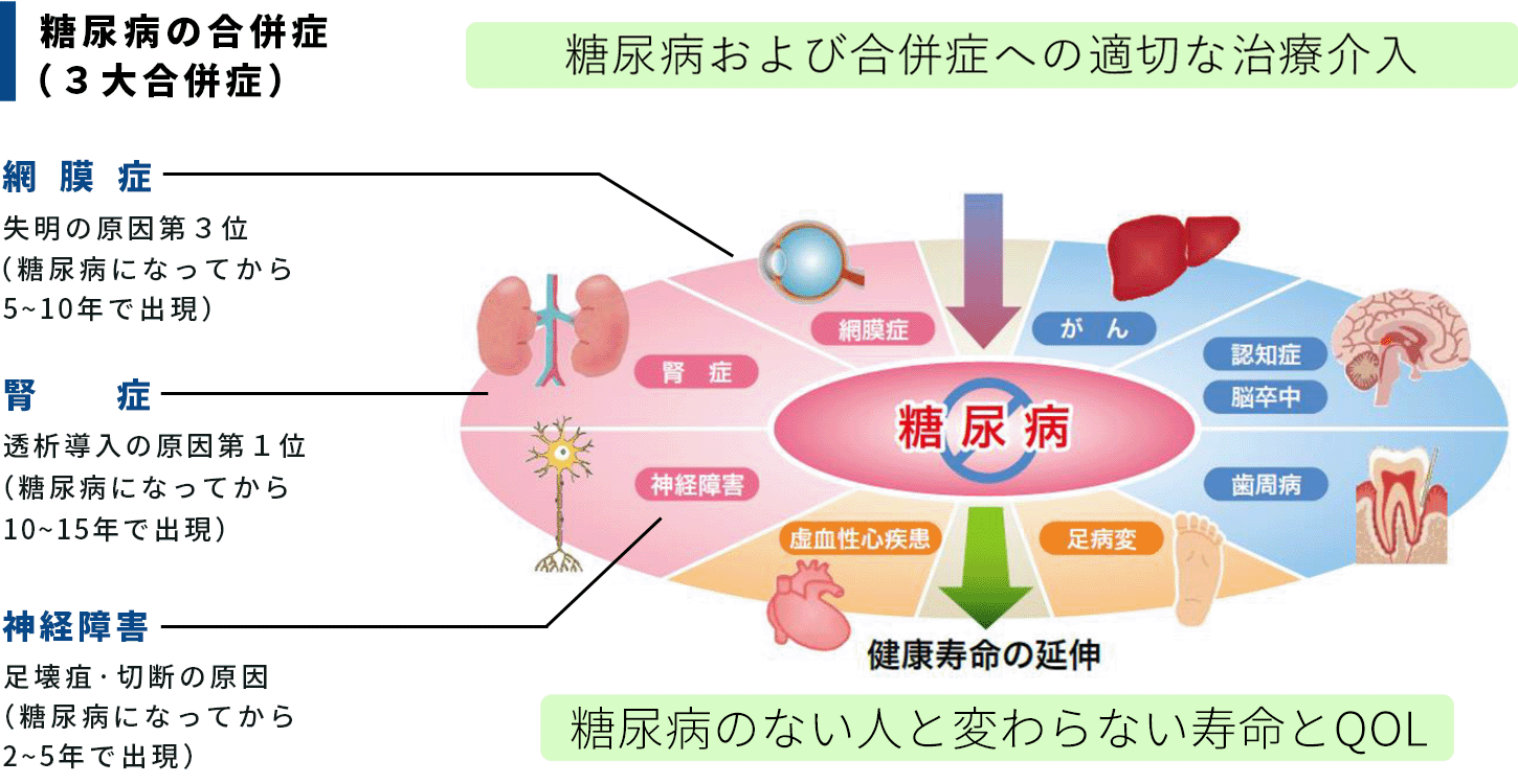 糖尿病および合併症への適切な治療介入