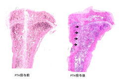 写真2　ラット脛骨骨きり後の組織標本。ＰＴＨ投与により骨癒合が促進した。