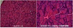 写真3　DMラットに対する活性型ビタミンD製剤と運動療法が筋萎縮を改善した。