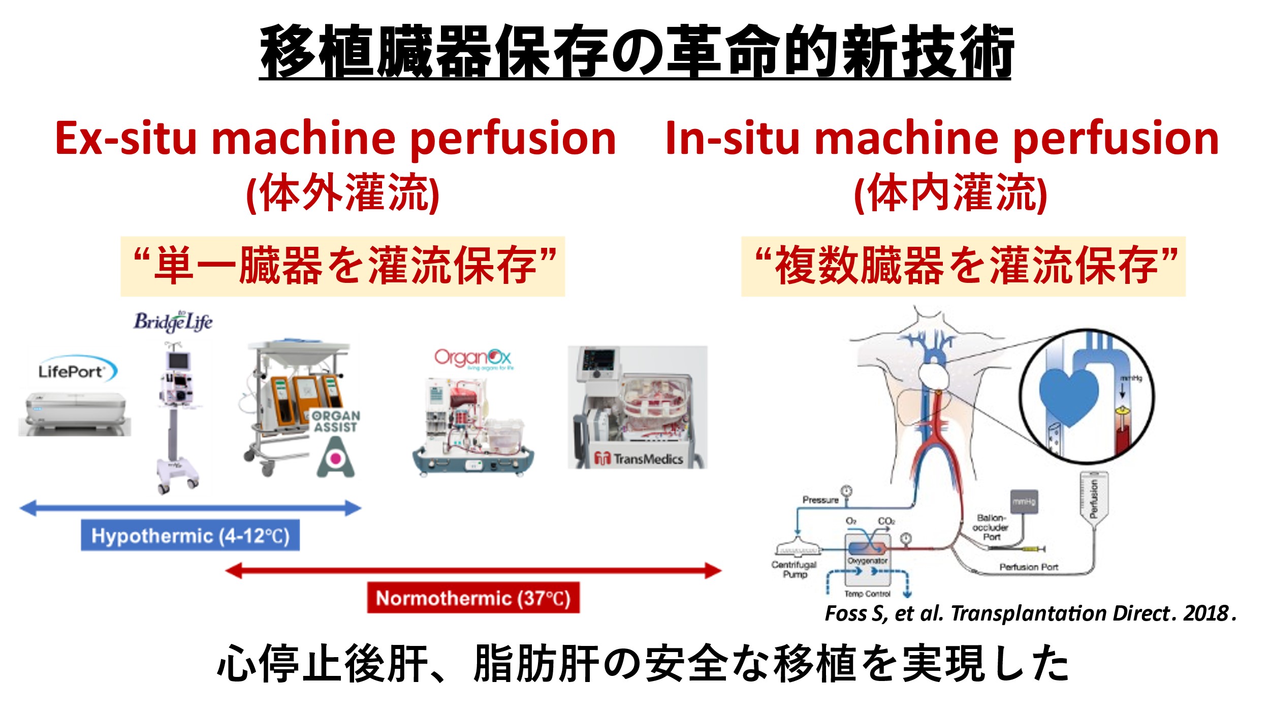 移植臓器保存の革新的新技術
