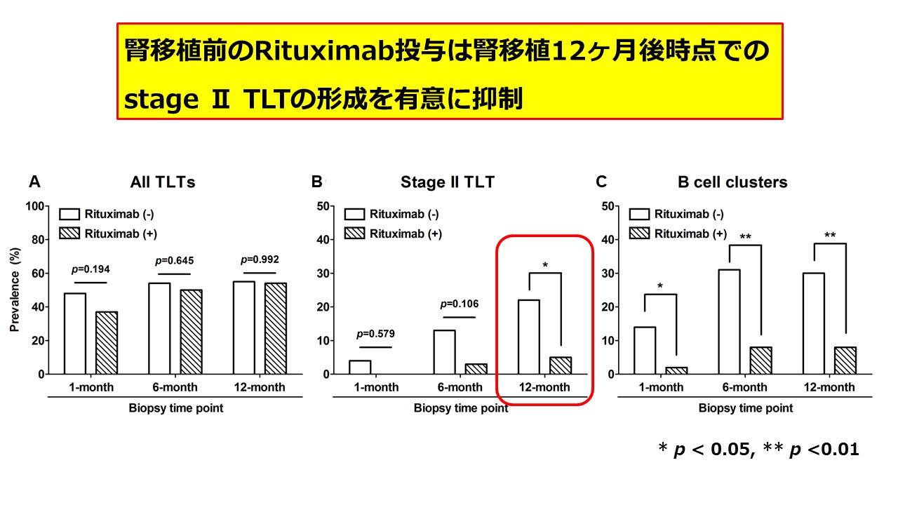 腎移植後の新たな予後不良因子を同定｜トピックス｜秋田大学