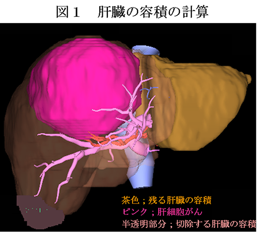 図1　肝臓の容量の計算