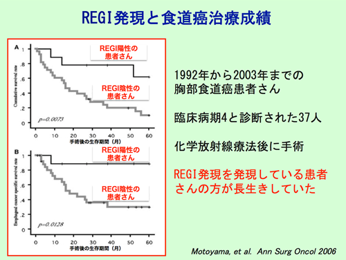 REGI発現と食道癌治療成績