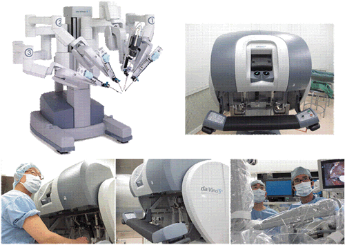 ロボット支援腹腔鏡下前立腺全摘除術