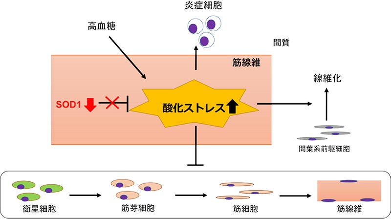 KK/Ta-Akitaマウスにおいて、SOD1の減少とそれに伴う酸化ストレスの亢進をきたし、過剰な炎症と線維化を背景に筋再生が遅延することを明らかにした