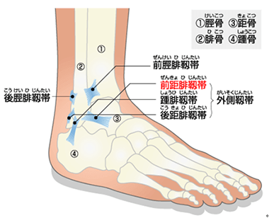 足関節外側靭帯損傷