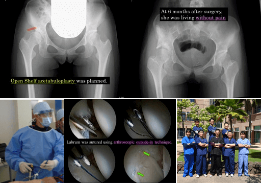 最先端の股関節診療の秋田県導入のために