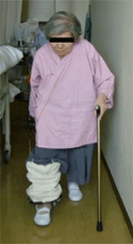 高齢骨粗鬆症骨折患者の退院マネージメント